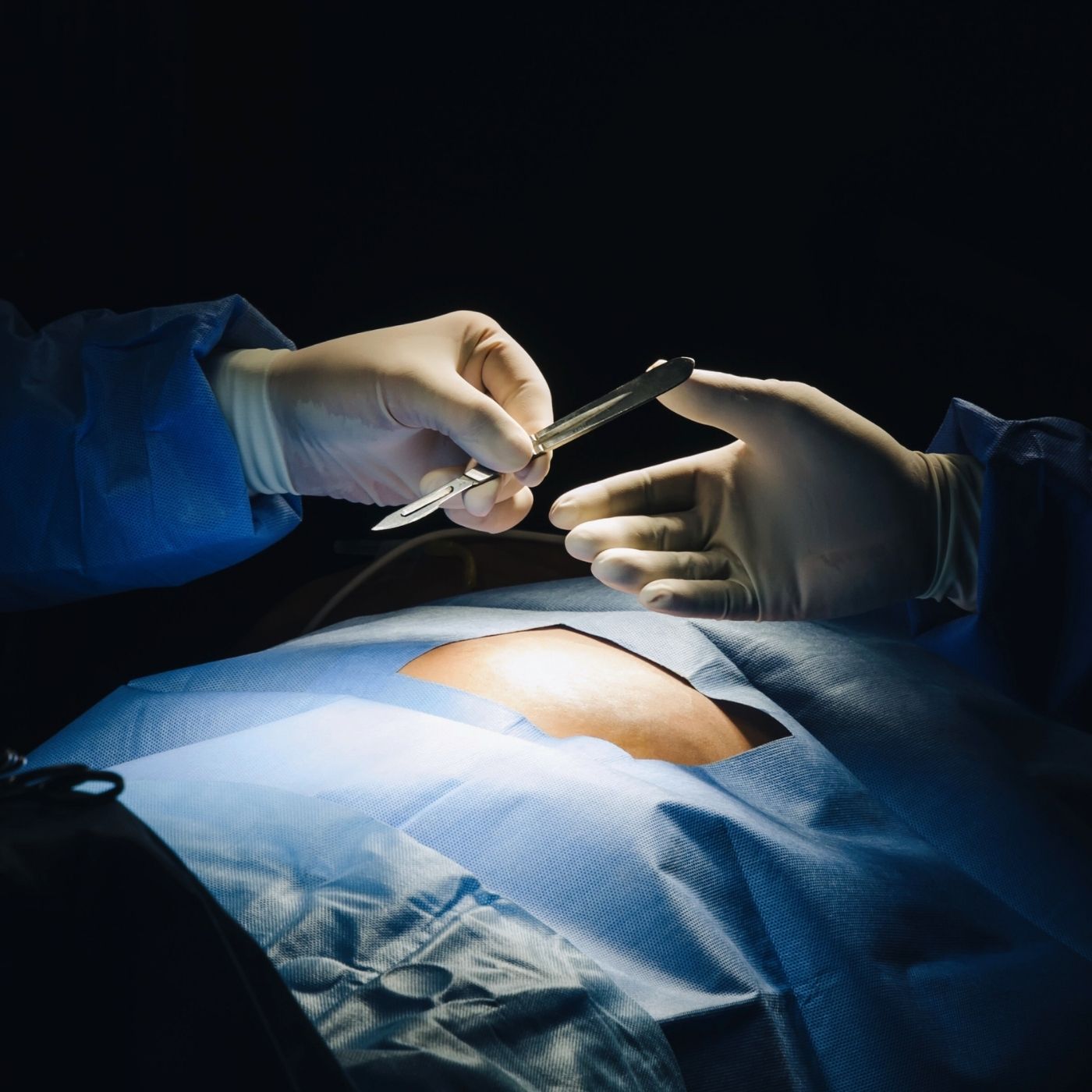 When organ donations go wrong… for the donor