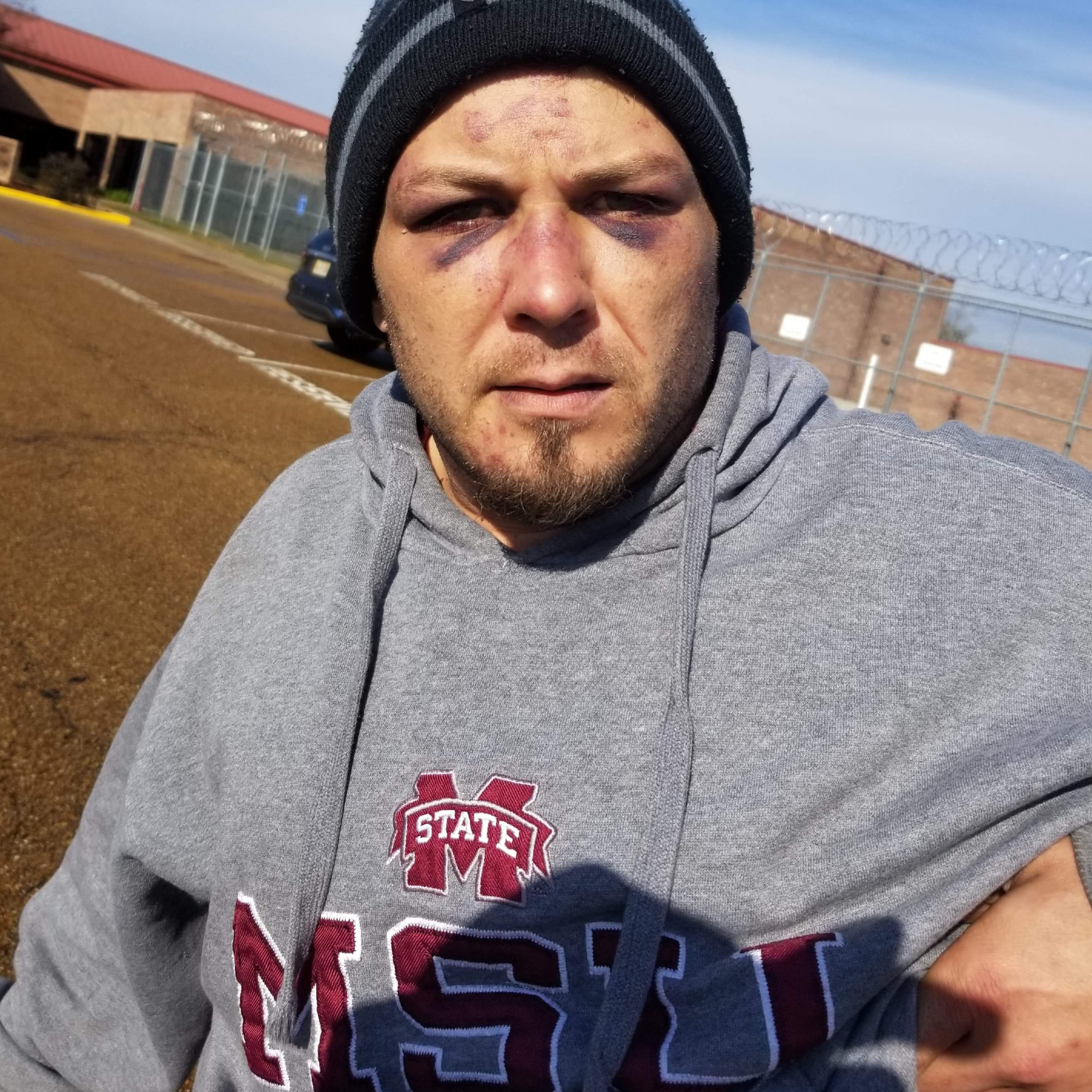 In a Mississippi Jail, Inmates Became Weapons