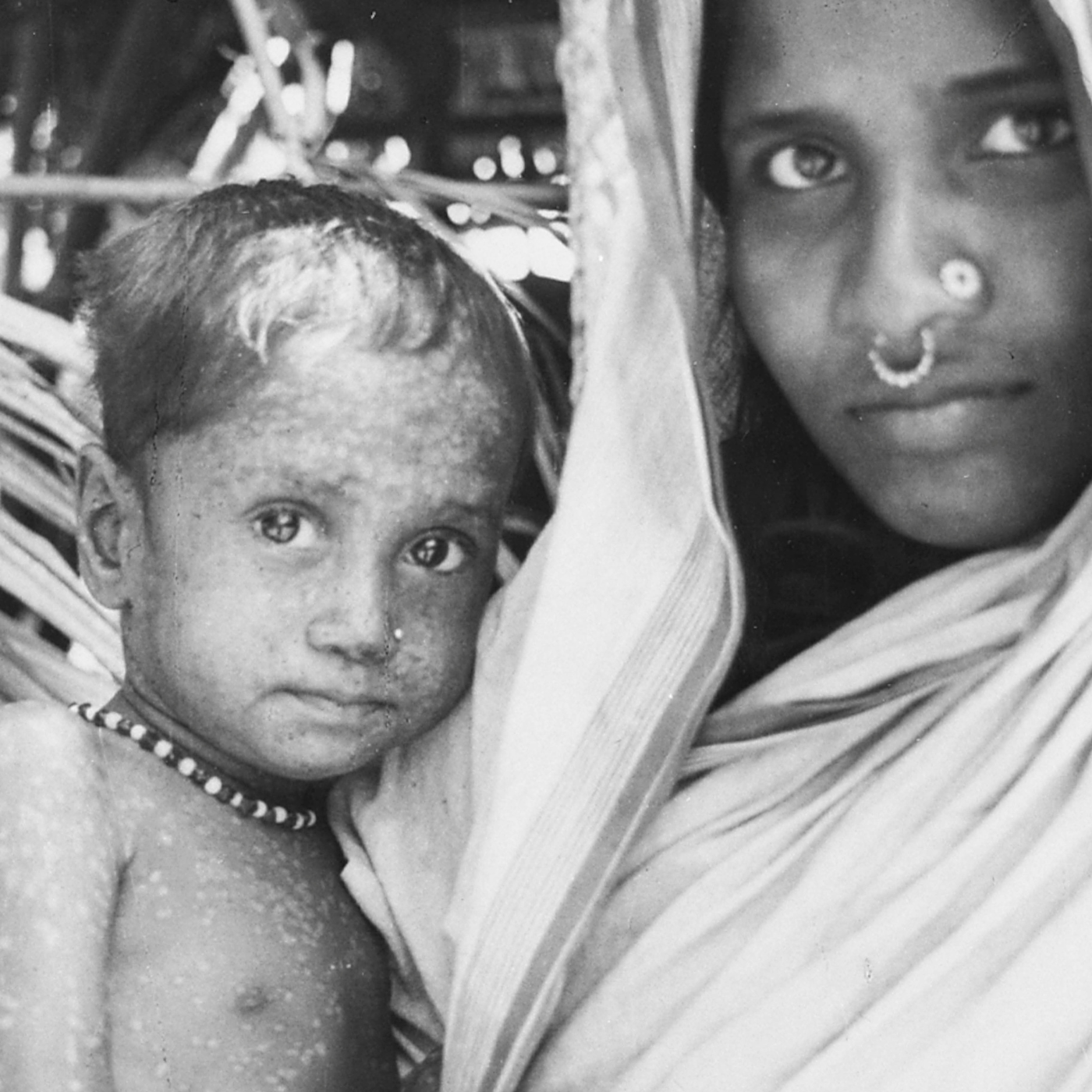 The End of Smallpox artwork